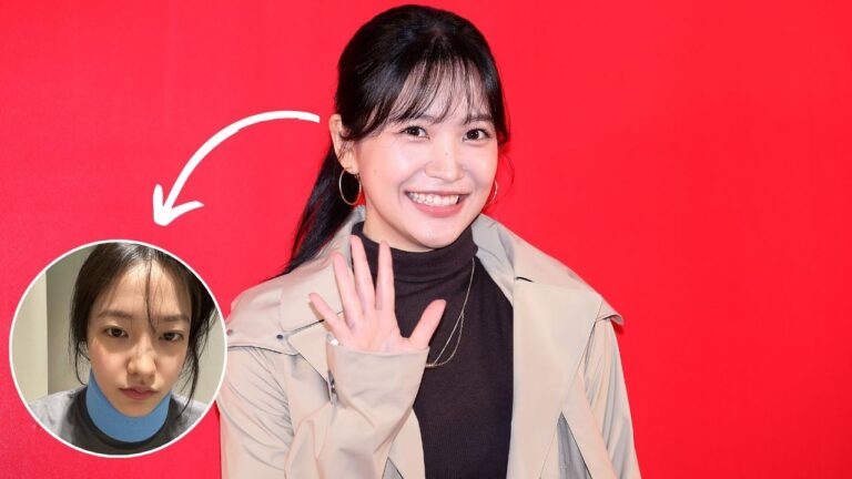 Yeri, do Red Velvet, sofre lesão séria no pescoço e atualiza fãs sobre seu estado de saúde